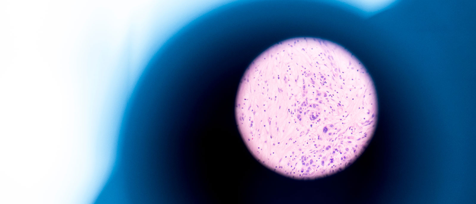 Sakura-Standardisation-Advanced-Staining-NordiC.jpg